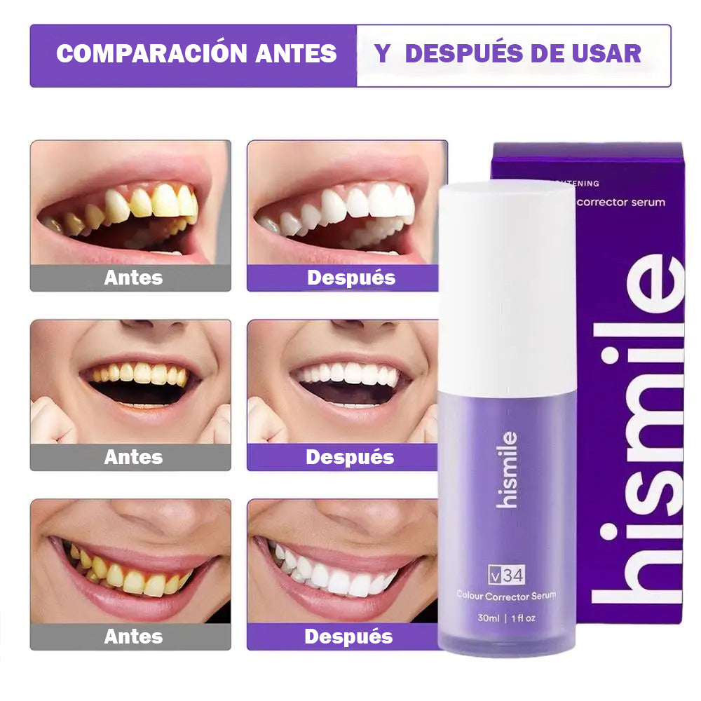 Hismile™ – Crema Dental Blanqueadora Premium